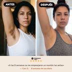 Antes y despues + testimonio 5 estrellas - Jabon BlanqueaOGT