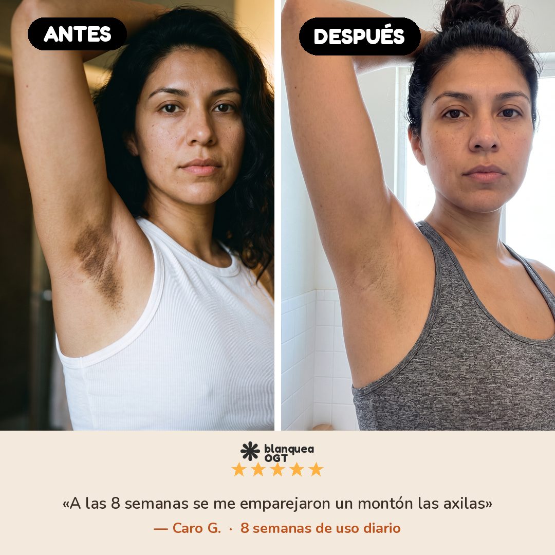 Antes y despues + testimonio 5 estrellas - Jabon BlanqueaOGT